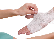 Burned hand